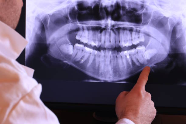 Best Pediatric Emergency Dentist in Spencer, WV
