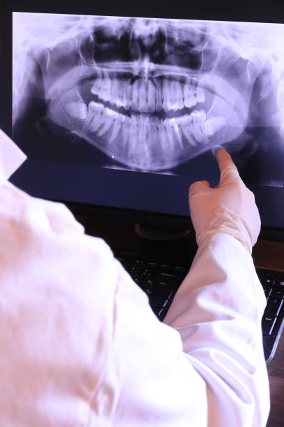 Best Emergency Dentist for Lost Fillings or Crowns in Spencer, WV