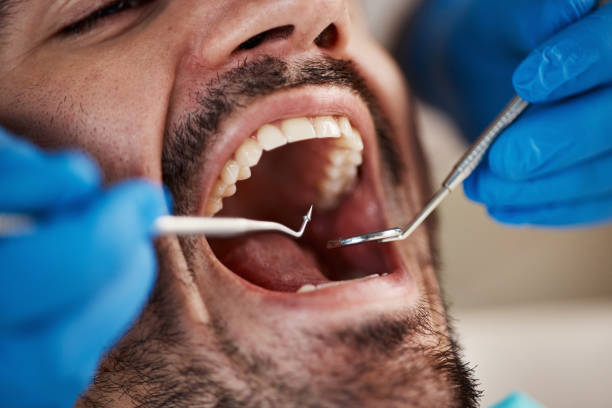 Best Broken or Cracked Tooth Emergency Dentist in Spencer, WV