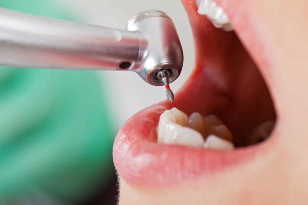 Best Mobile Emergency Dentist in Spencer, WV